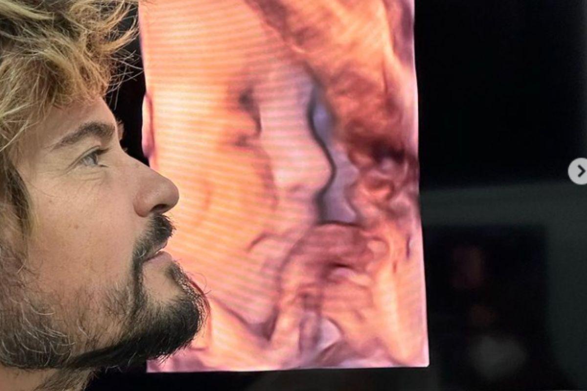 Paulo Vilhena mostra o ultrassom da filha e semelhança impressiona