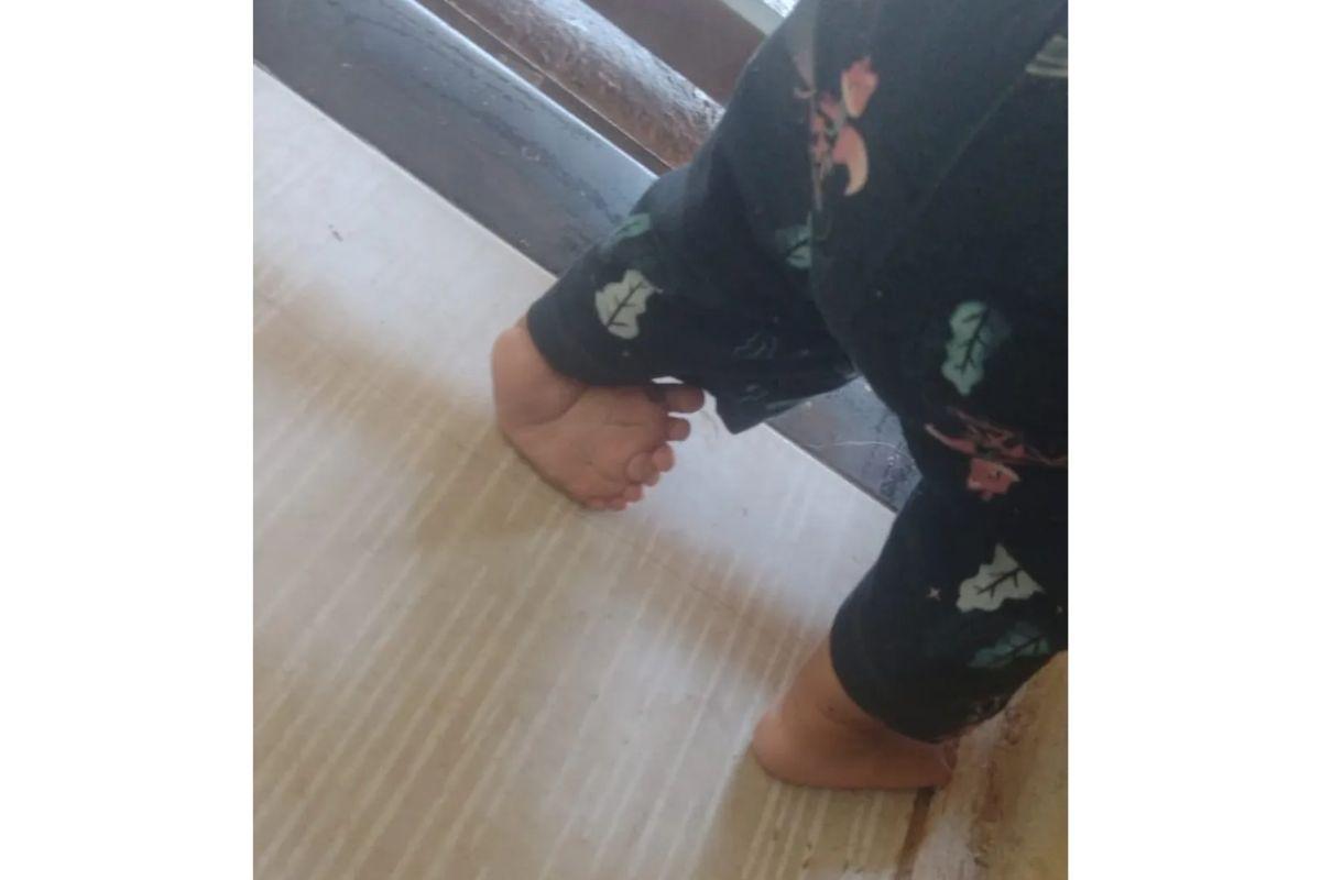 A criança não consegue andar por conta da dor