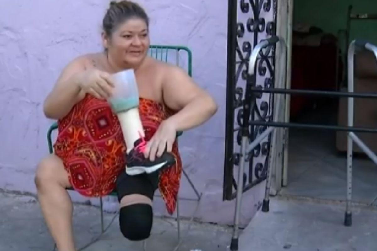 Mulher usa liquidificador como prótese após amputar a perna