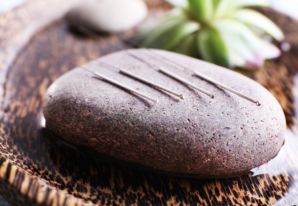 acupuntura para a família