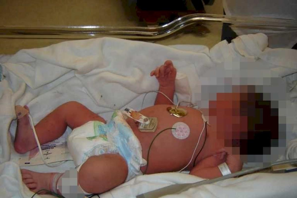 Após 3 paradas cardíacas, a bebê voltou a viver