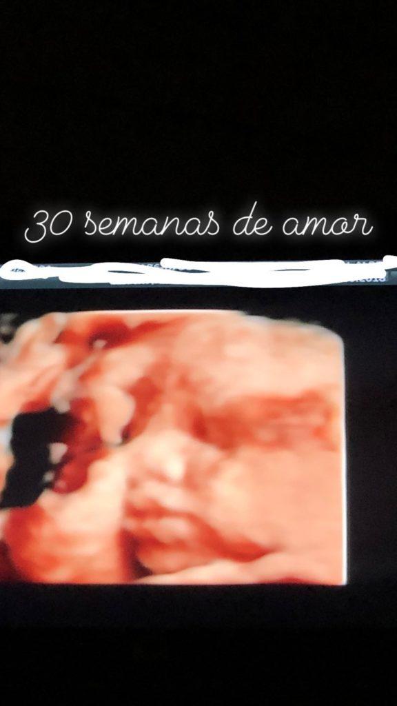 (Foto: reprodução / Stories @sabrinasato)