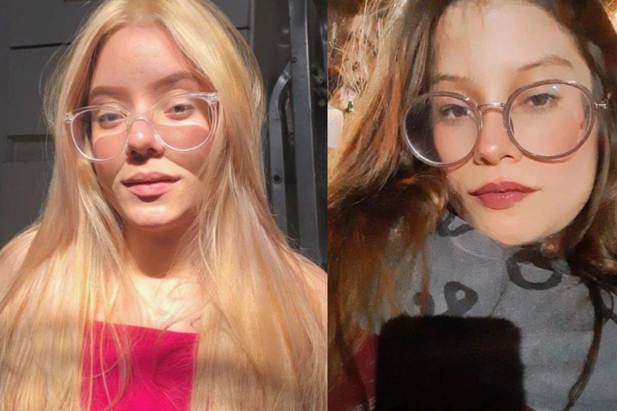 Ruth e Ruthiellen as gêmeas siamesas que foram separadas