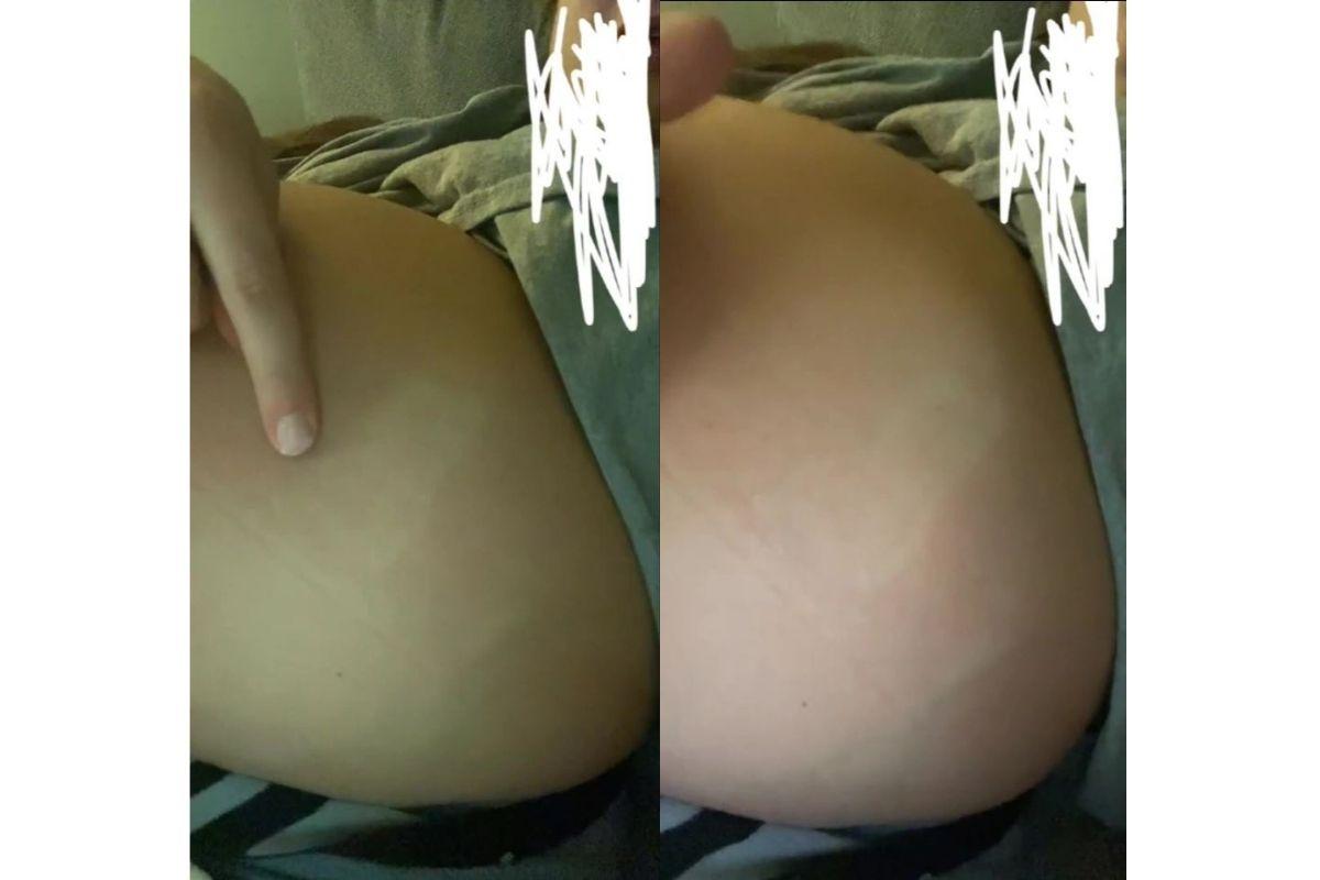 A marca do pé ficou certinha na barriga dela