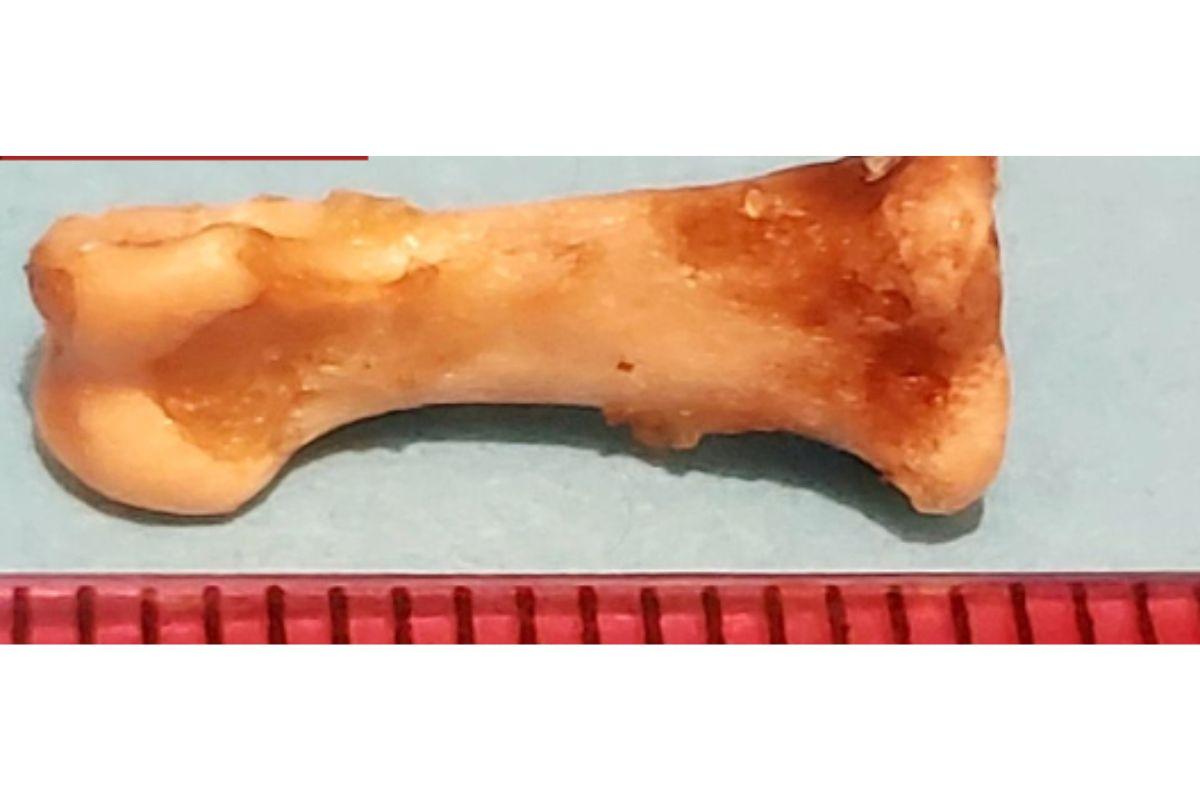 Mulher encontra osso em salgadinho