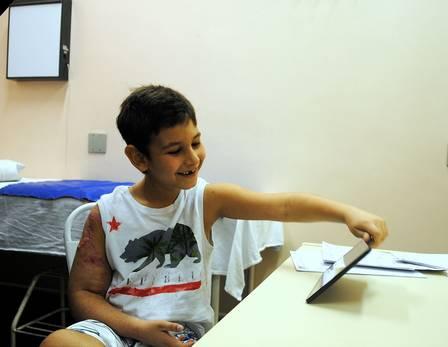 Menino braço reimplantado 3