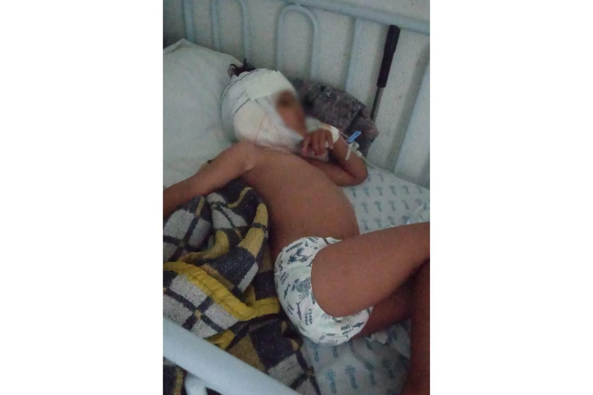 Criança atacada por pitbull