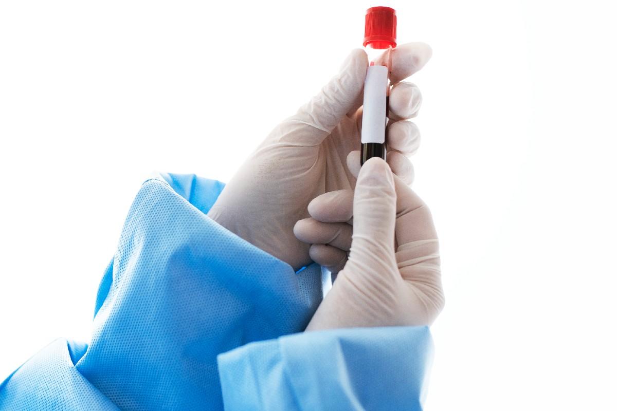 Segurando tubo de ensaio