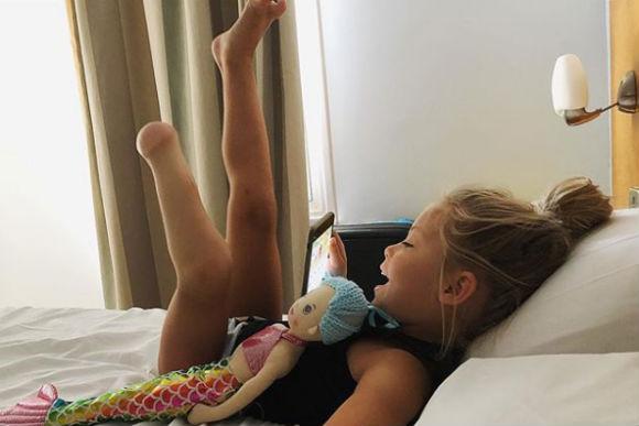 menina-perna-amputada2