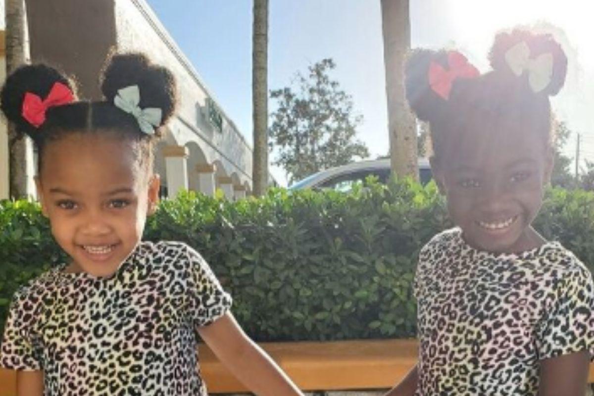 Gêmeas nascem com tons de pele diferentes e chamam atenção