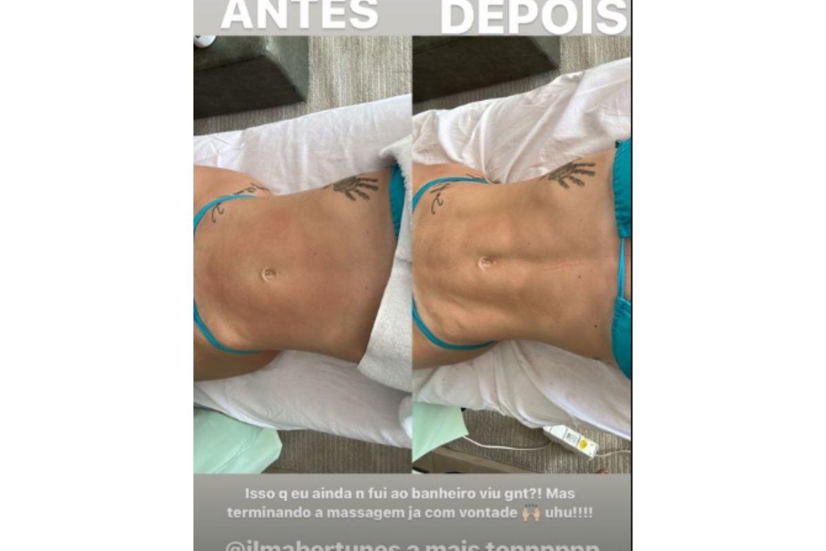 Virginia mostra resultado da massagem para ir ao banheiro 