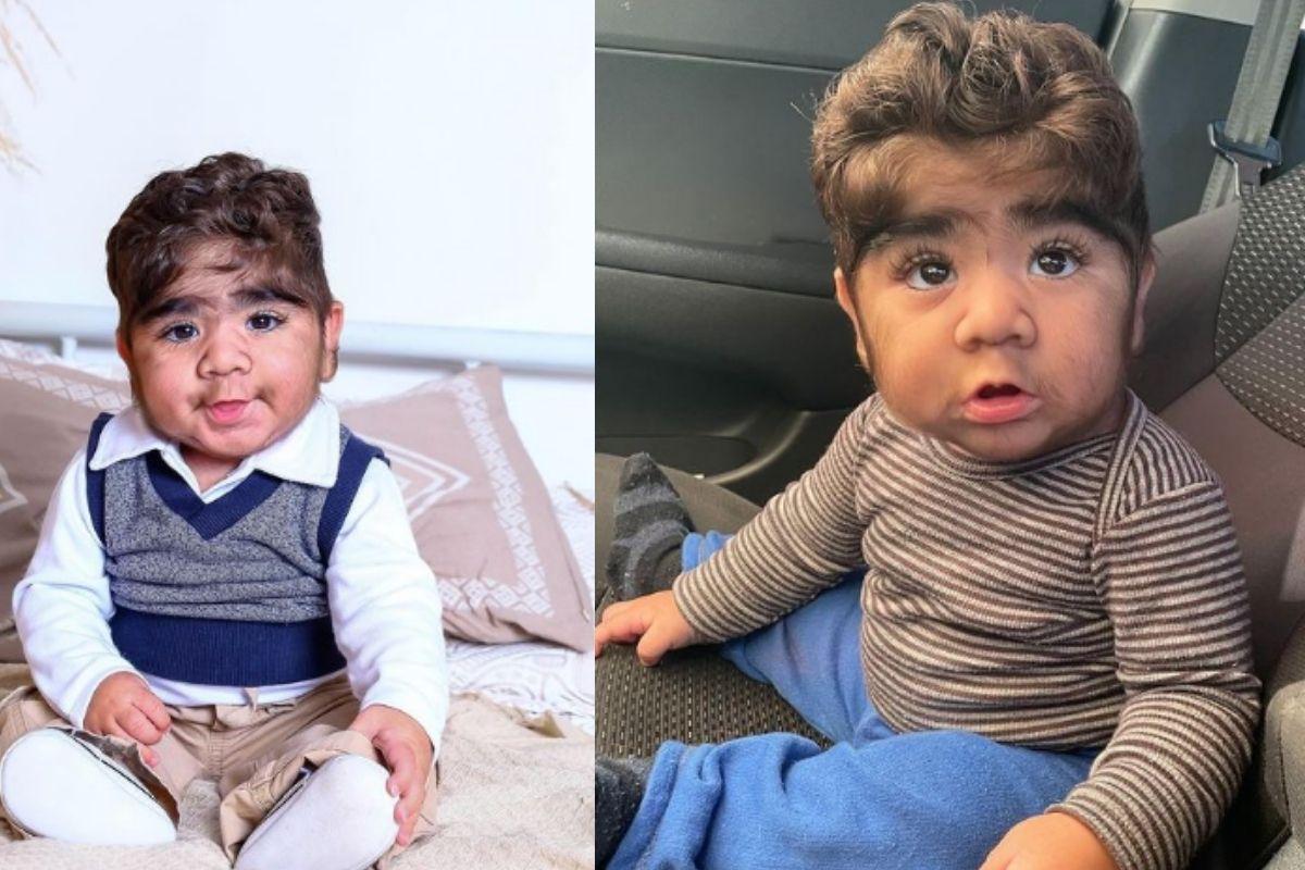 João herdou a condição da família 