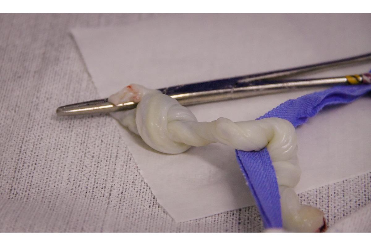 Uma pessoa ouviu o choro da bebê de dentro da bolsa térmica e chamou as autoridades para o resgate