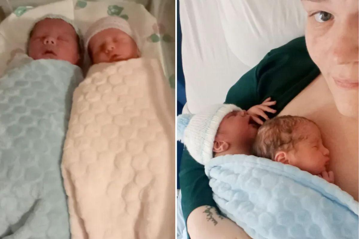 Gêmeos nascem ao mesmo tempo em caso raro