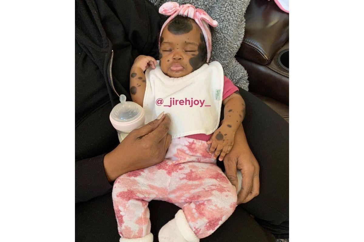 "Eu a chamo de linda porque ela é", diz Toneka, mãe de Jireh