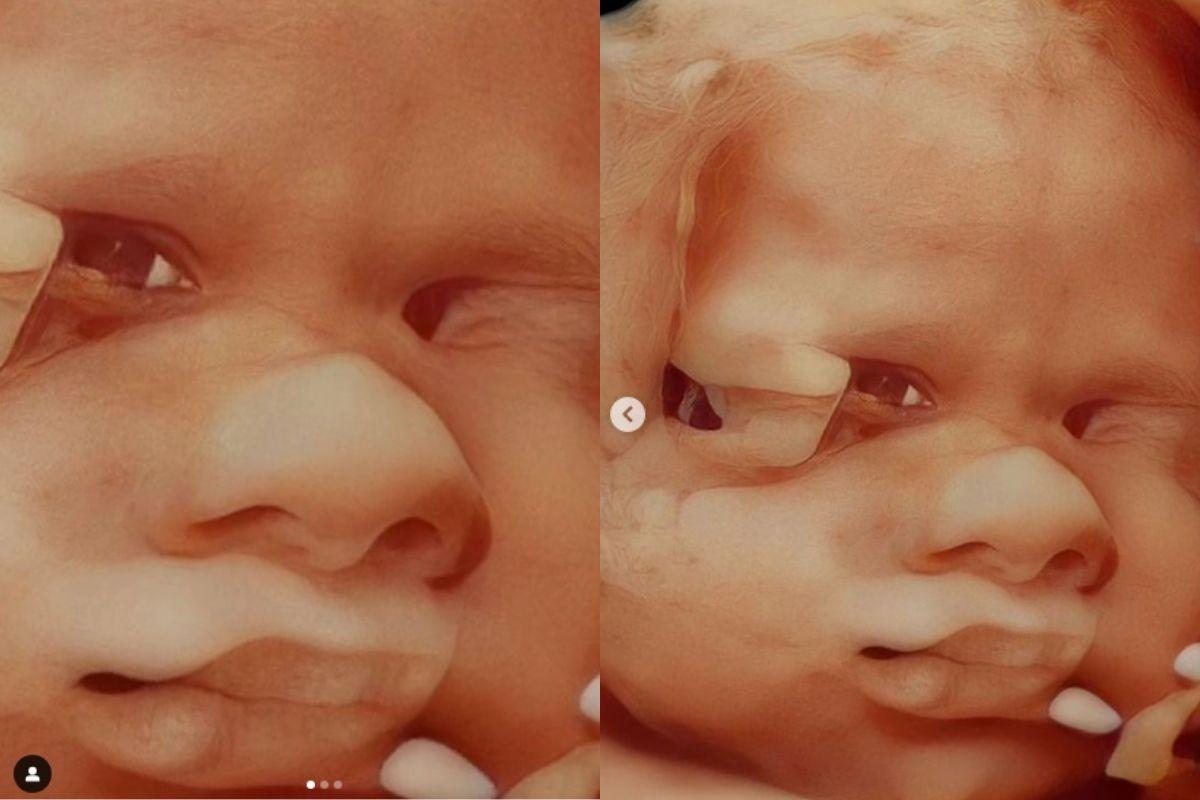 Ultrassom Michelle Loreto 