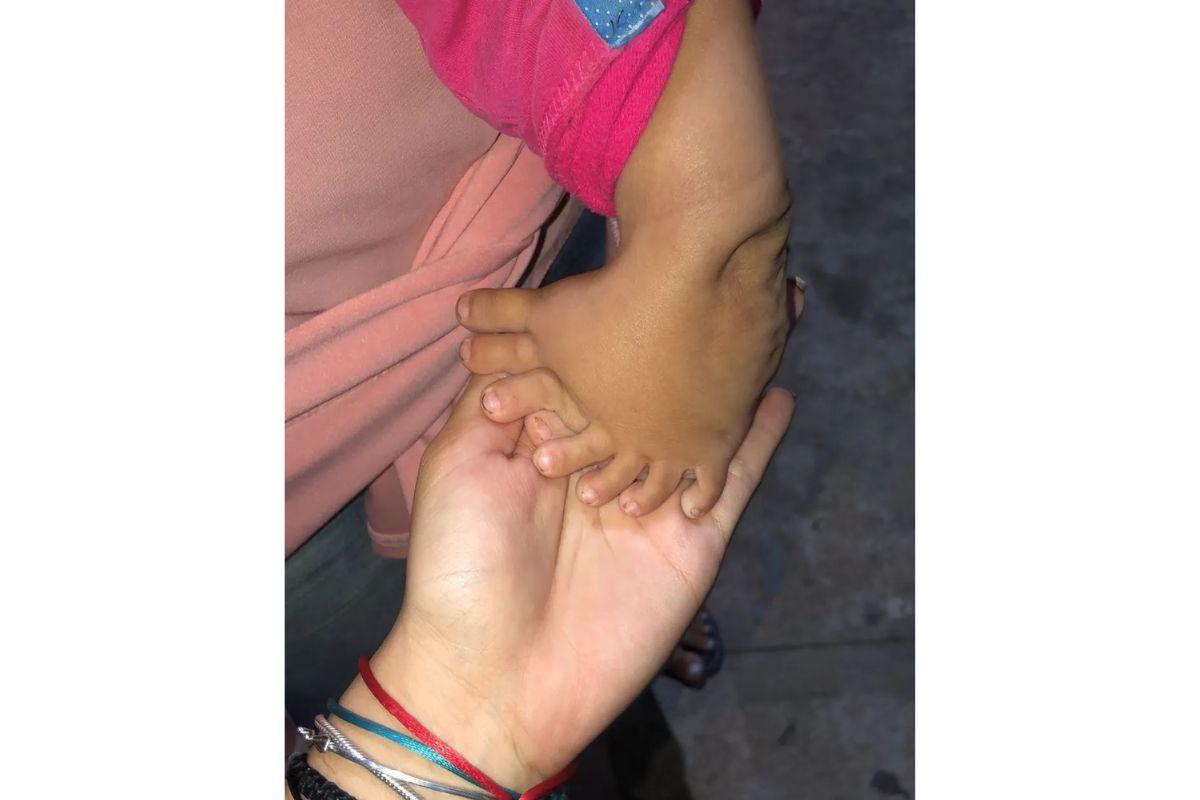 A menina tem 8 dedos no pé esquerdo