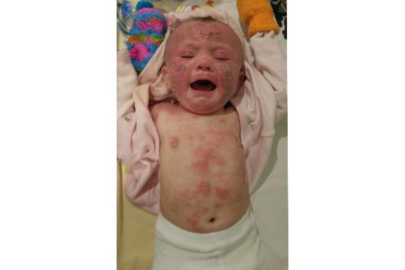 (Foto: Caters News Agency)