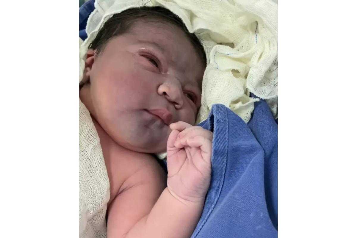 O bebê surpreendeu os médicos pelo peso