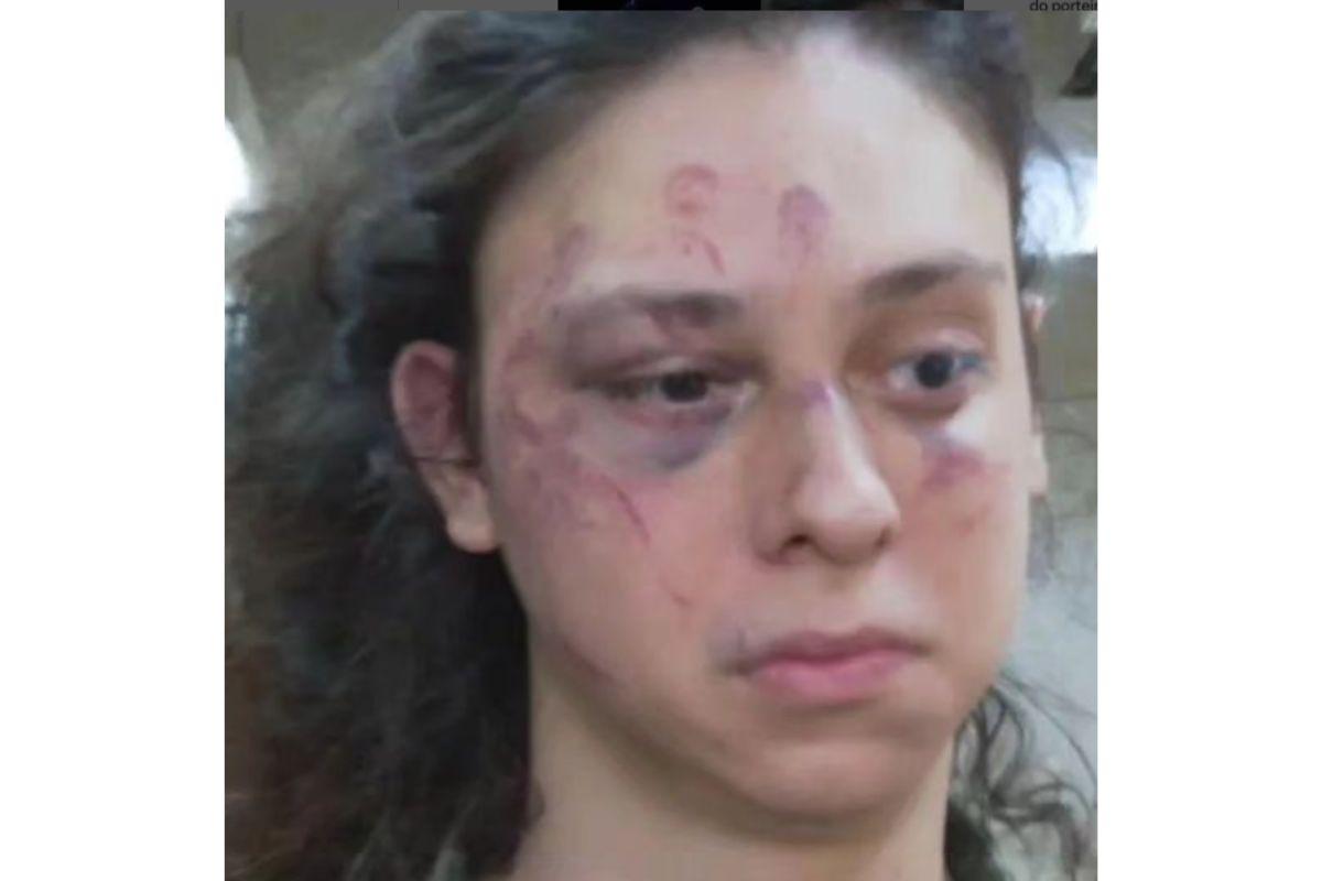 Victor Meyniel, ator Victor Meyniel, Victor Meyniel espancado, agressor de Victor Meyniel, o que aconteceu com Victor Meyniel