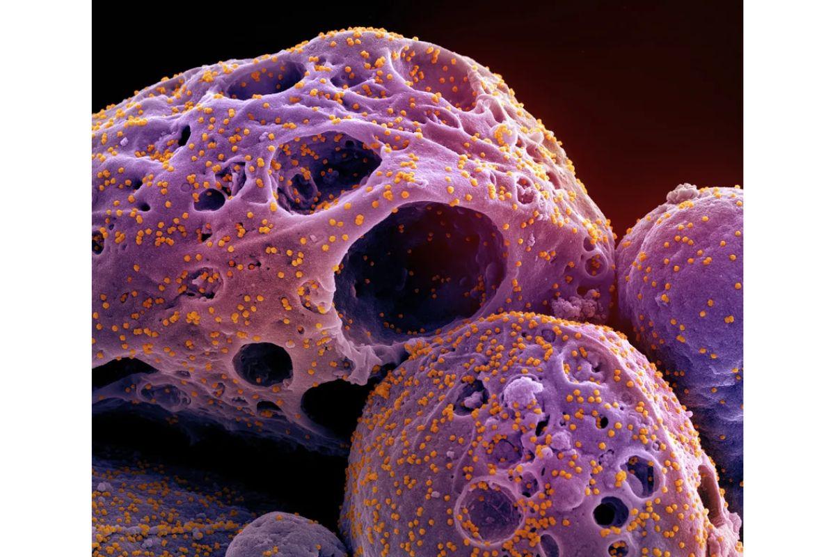 Subvariante do Covid 