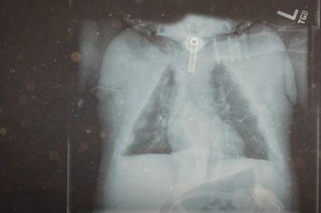 Janelly aos 18 meses