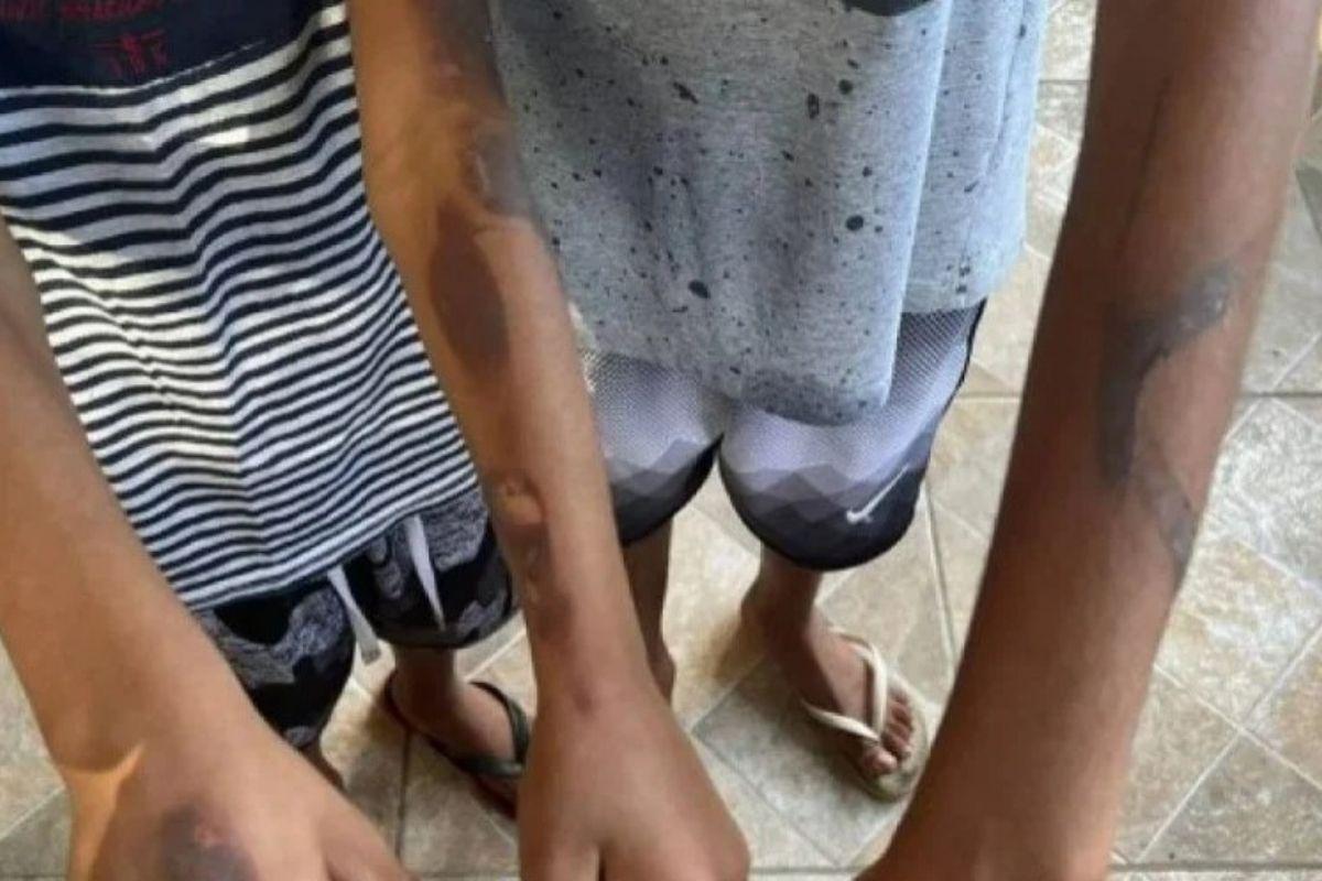 As crianças eram queimadas com colher quente pela mãe