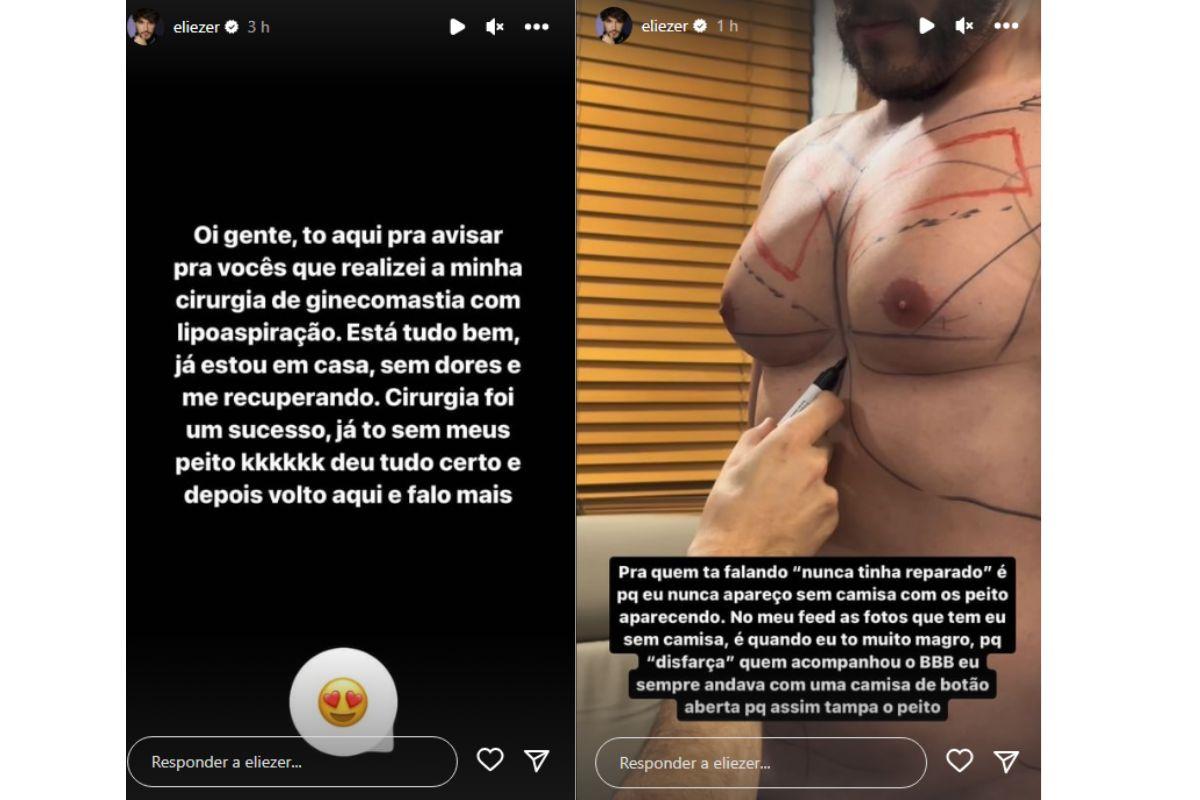 Eliezer, pai de Lua di felice, namorado Viih Tube, cirurgia Eliezer, operação Eliezer, ginecomastia Eliezer, peitos Eliezer