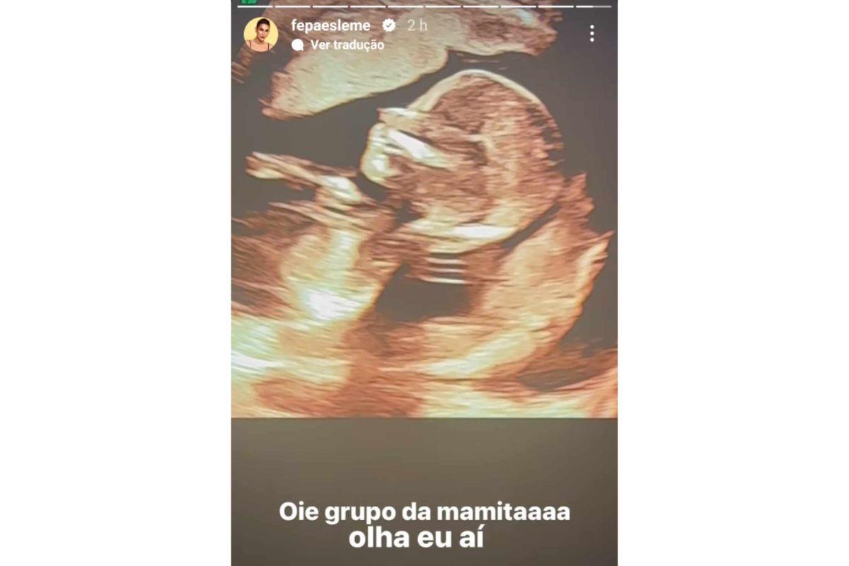 Ultrassom Fernanda Paes Leme