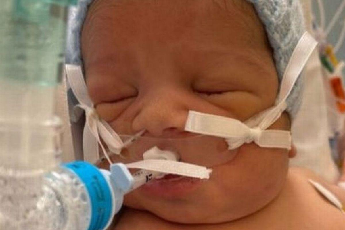 Bebê é diagnosticado com síndrome minutos antes de deixar hospital: “Não iria sobreviver em casa”