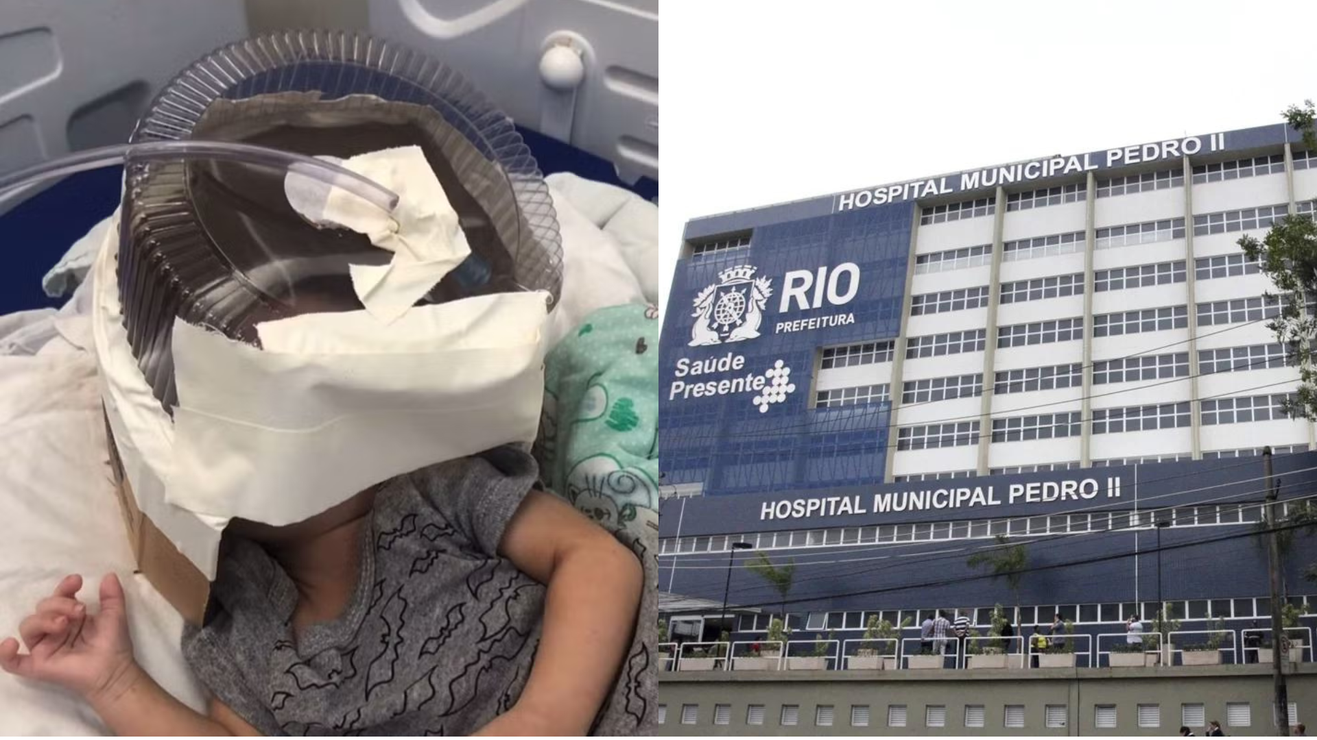 Beb&ecirc; de tr&ecirc;s meses precisa usar m&aacute;scara de oxig&ecirc;nio improvisada no RN