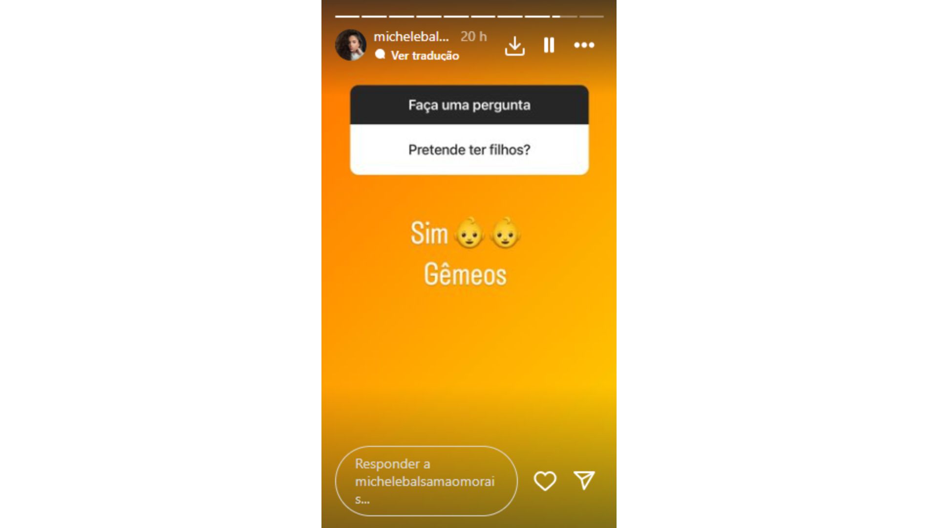 Namorada de Duda Nagle conta que quer ser m&atilde;e de g&ecirc;meos
