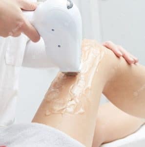 Quer Fazer Depilação a Laser? Não Cometa Esse Erro Comum!