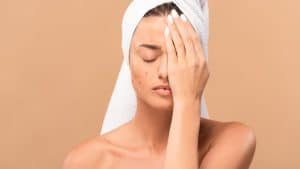 Diga Adeus às Espinhas! Rotina de Cuidados Para Uma Pele Perfeita