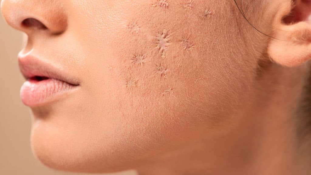 Os Tratamentos Mais Poderosos Contra Manchas na Pele que Você Precisa Conhecer!