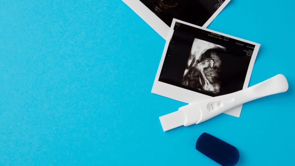 Ultrassom e teste positivo de gravidez em um fundo azul.