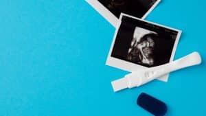 Ultrassom e teste positivo de gravidez em um fundo azul.