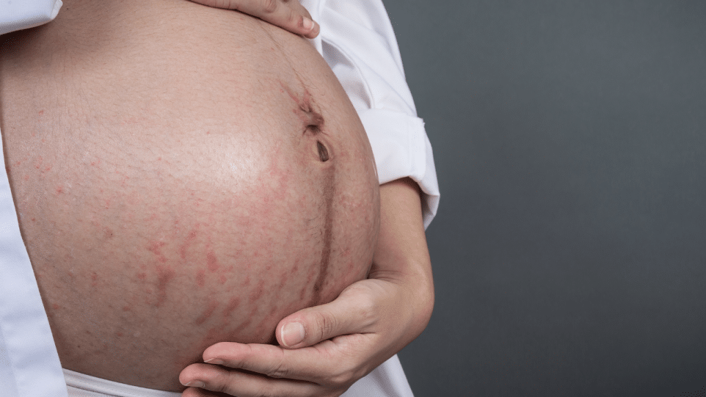 Barriga de mulher grávida